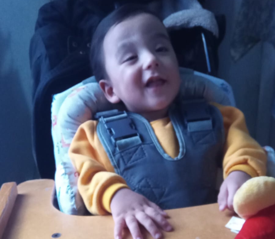 Tiene año y medio, va camino a la ceguera por su hidrocefalia y sus padres lanzan una rifa para costear gastos